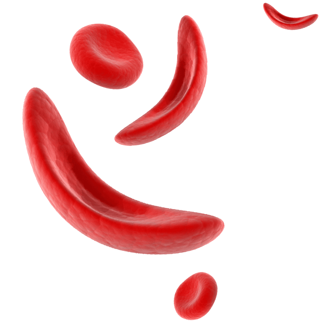 innovhem sickle cell disease innovhem sickle cell disease